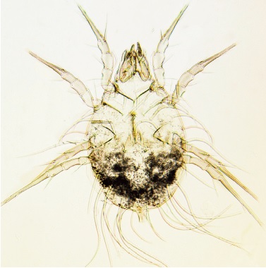 Glycyphagus domesticus - femmina - foto di Mario Principato